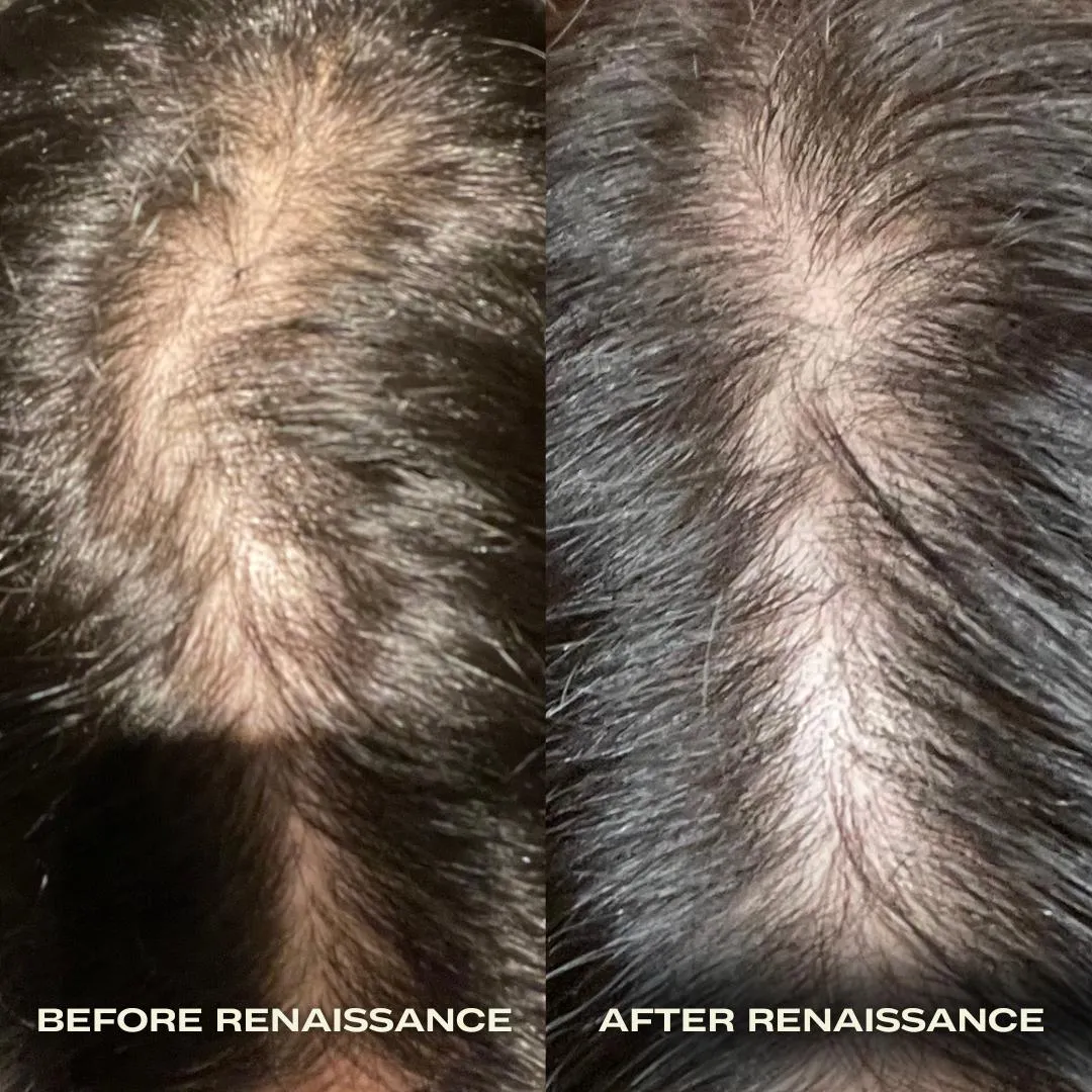 Renaissance Nourishing Hair Oil